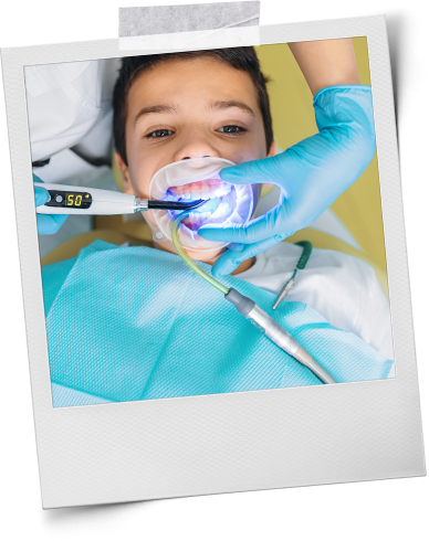 Dental Sealants